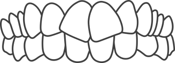 Invisalign-Best-Orthodontist-in-India-Bengal-Kolkata-Dentotsav-Dental-Clinic