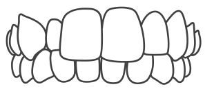 Invisalign-Best-Orthodontist-in-India-Bengal-Kolkata-Dentotsav-Dental-Clinic