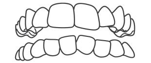 Invisalign-Best-Orthodontist-in-India-Bengal-Kolkata-Dentotsav-Dental-Clinic