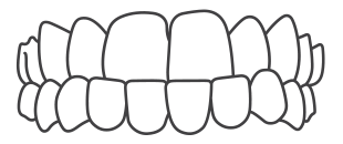 Invisalign-Best-Orthodontist-in-India-Bengal-Kolkata-Dentotsav-Dental-Clinic