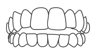 Invisalign-Best-Orthodontist-in-India-Bengal-Kolkata-Dentotsav-Dental-Clinic