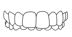 Invisalign-Best-Orthodontist-in-India-Bengal-Kolkata-Dentotsav-Dental-Clinic