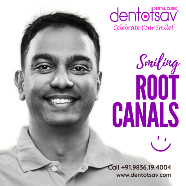 Expert Root Canal Treatment at Dentotsav Dental Clinic