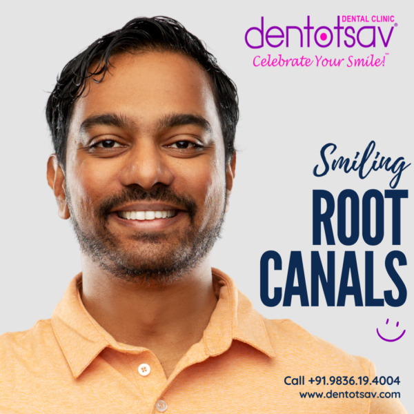 Expert Root Canal Treatment at Dentotsav Dental Clinic