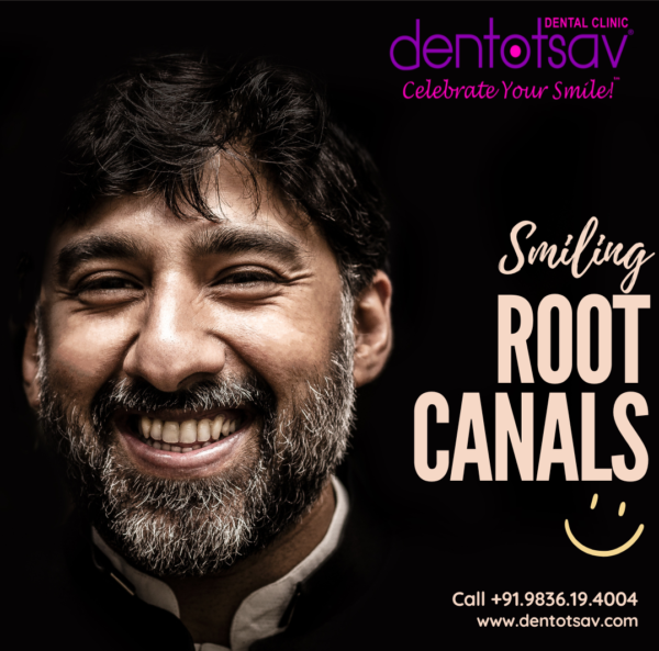 Expert Root Canal Treatment at Dentotsav Dental Clinic