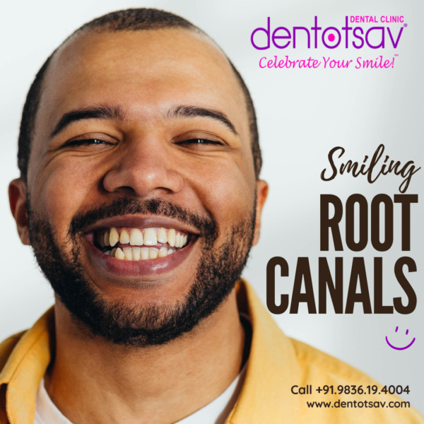 Expert Root Canal Treatment at Dentotsav Dental Clinic